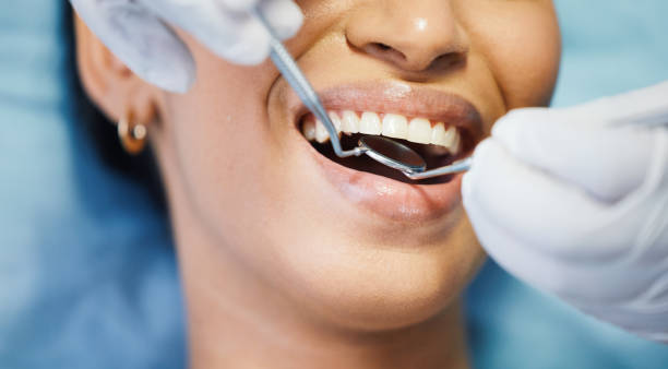 Best Emergency Treatment for Dental Infections or Abscesses in Millington, NJ