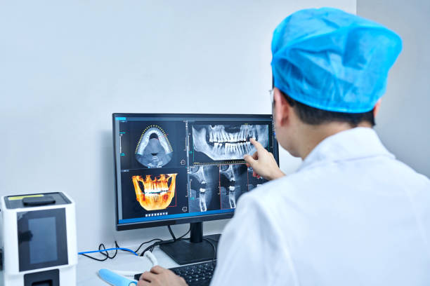 Best Urgent Care for Lost Fillings or Crowns in Millington, NJ